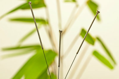 Acupuncture needles for your TCM treatment