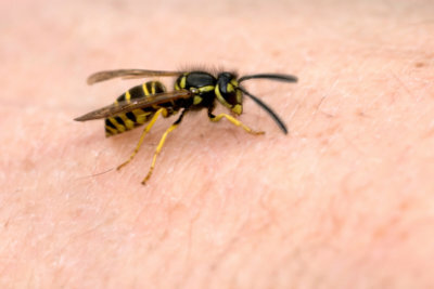 Le punture di vespa sono un fastidio doloroso, soprattutto per i bambini.