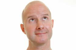 A kopasz fej borotválása a visszahúzódó hajszál elfedése érdekében szintén opció.