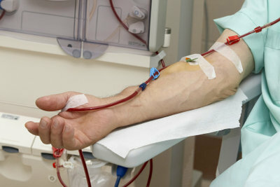 Dialysis removes toxins from the blood.