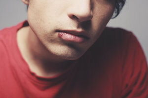 Herpes is particularly common on the lip.