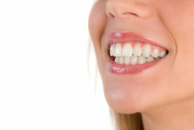 White teeth make a smile more attractive.