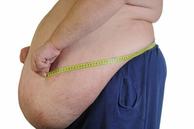 Ожирение может привести к геморрою.