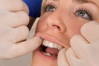 Orthodontists also use the Kaunudel.