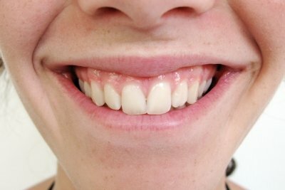 Tænder består af mange lag.