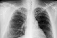 Keuhkoputket ja toiminta