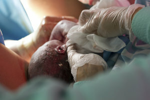 You can combine a caesarean section with sterilization.