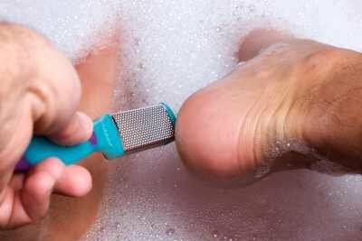 Hvad kan du ellers gøre ved stinkende fødder? Fjern for eksempel callus med en rasp.