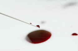 Blod domineras av de röda blodkropparna.