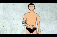 비디오: 팔꿈치의 건염