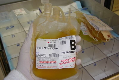 Il plasma sanguigno viene ricompensato più di una donazione di sangue intero.