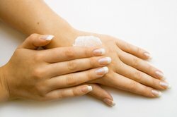 Menerapkan lotion dapat membantu melawan jerawat di tangan.