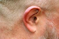 Tragus ant ausies skauda