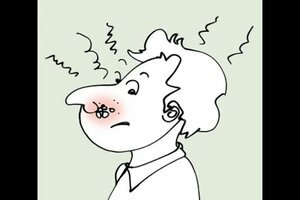 Herpes on the nose - what to do 